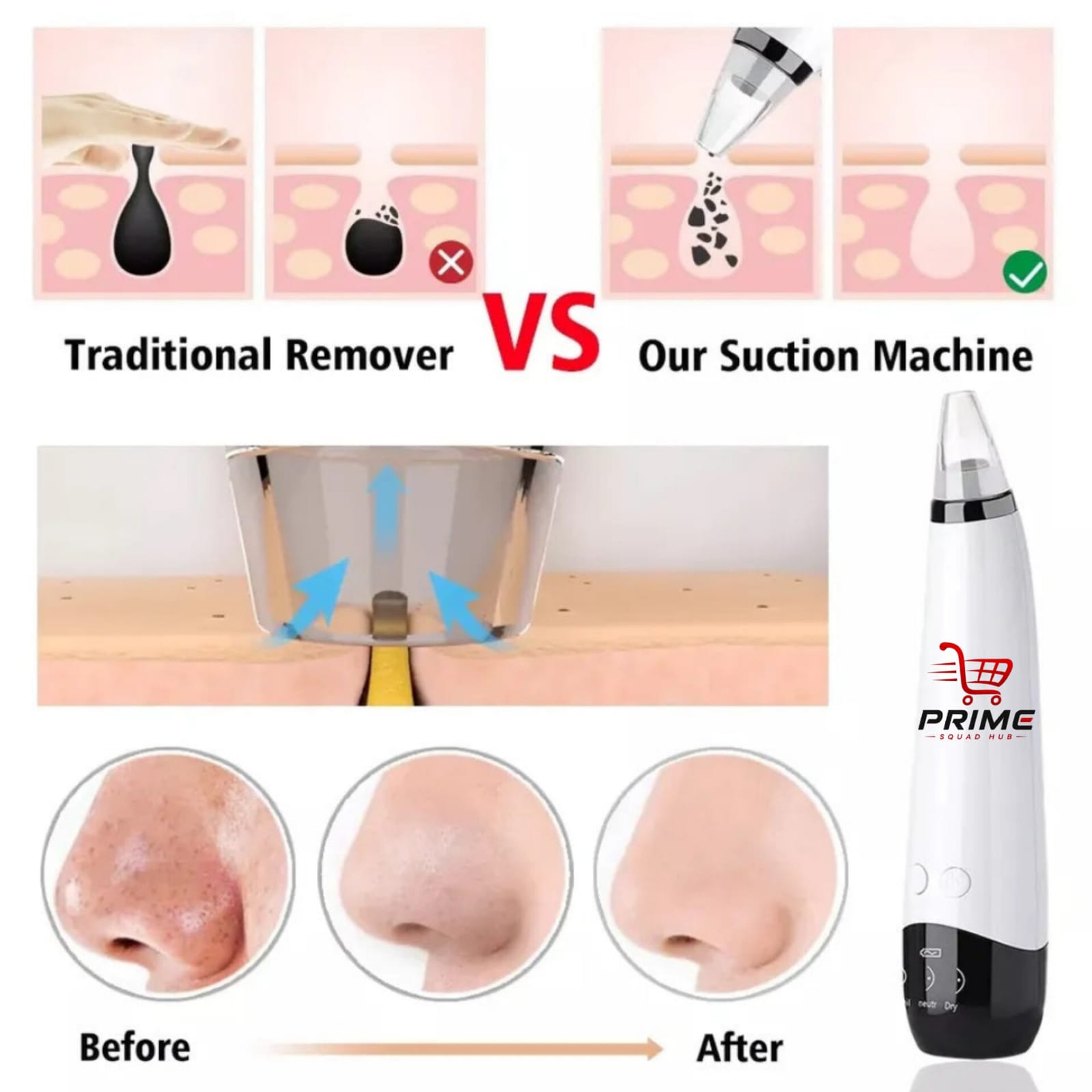 5 in 1 Electric Blackhead Acne Oil Remover