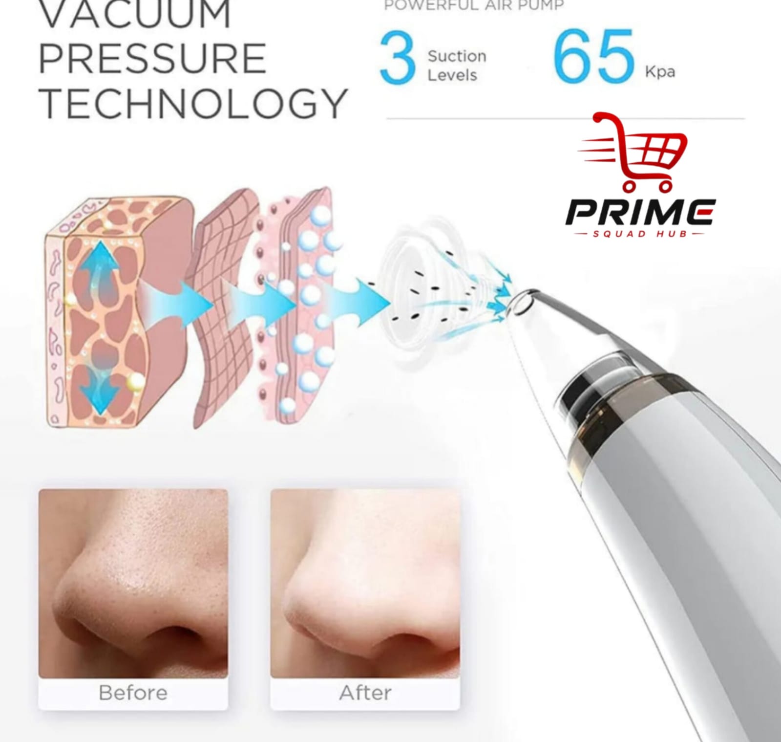 5 in 1 Electric Blackhead Acne Oil Remover